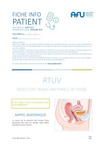 Résection transurétrale de vessie