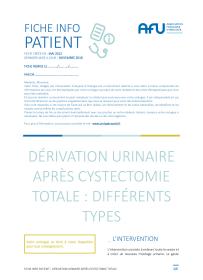Dérivations urinaires : différents types