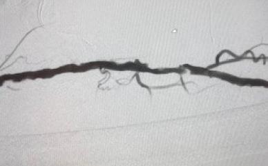 image_chirurgie_endovasculaire_arlonvirton.jpg