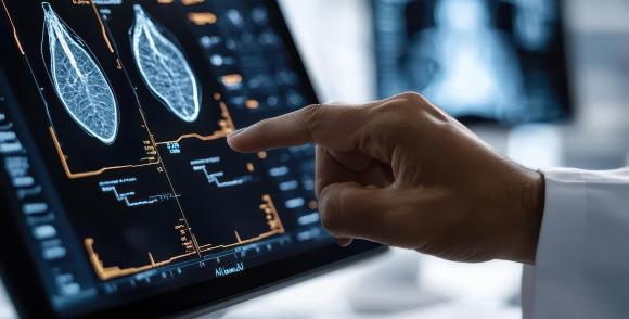 échographie prostate