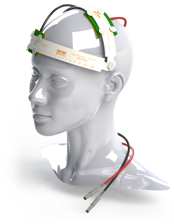 Stimulation transcrânienne TDCS - Vivalia Neurologie Stimulation transcrânienne TDCS - Vivalia Neurologie