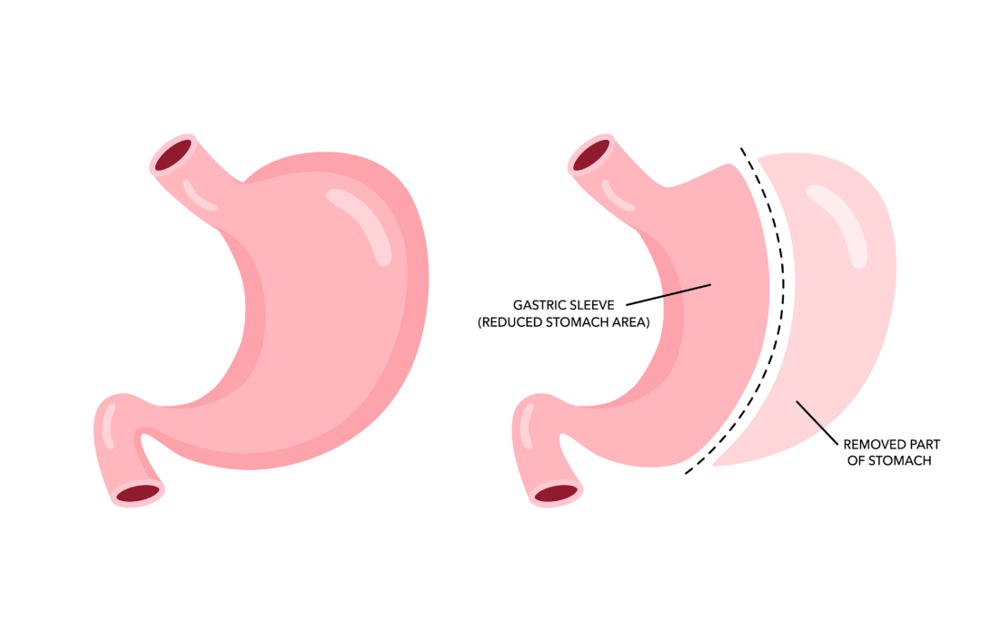 sleeve.png sleeve.png
