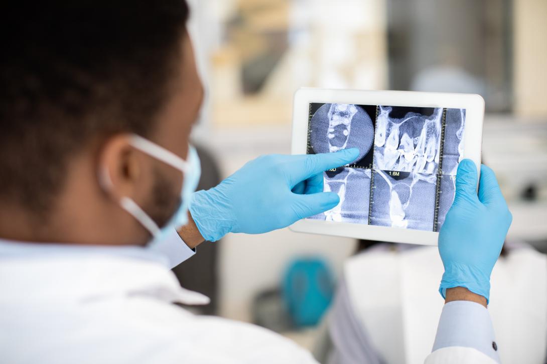 illustration technologie radio chirurgie orale (source : adobe stock)